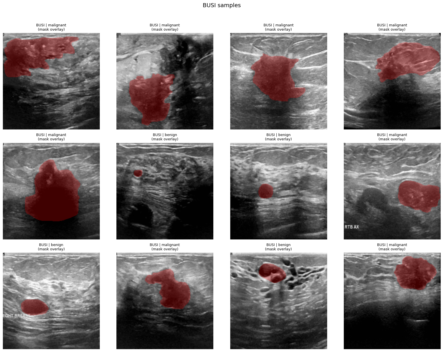 HW1: sample ultrasound images with masks